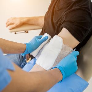 Burns Treatment Near Me in Houston, TX and Livingston, TX