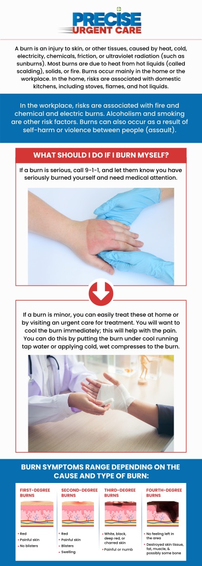 Common questions asked by patients: What are the different types of burns? What should I do immediately after suffering a burn? How are burns treated at urgent care clinics? How long does it take for a burn to heal? What are the symptoms of a second-degree burn? Can burns cause long-term complications if untreated? At Precise Urgent Care, Board-Certified Dr. Rajan Popat, MD, and our team provide immediate assessment and care for minor to moderate burns. We utilize sterile techniques to clean and dress wounds while managing pain to significantly reduce the risk of infection. Visit us for prompt, compassionate treatment that promotes faster healing and minimizes scarring. For more information, contact us or online check-in. We are conveniently located at 1501 W Church St, #800 Livingston, TX 77351. We serve patients from Livingston TX, West Livingston TX, West Tempe TX, Leggett TX, Onalaska TX and surrounding areas. Common questions asked by patients: What are the different types of burns? What should I do immediately after suffering a burn? How are burns treated at urgent care clinics? How long does it take for a burn to heal? What are the symptoms of a second-degree burn? Can burns cause long-term complications if untreated?
At Precise Urgent Care, Board-Certified Dr. Rajan Popat, MD, and our team provide immediate assessment and care for minor to moderate burns. We utilize sterile techniques to clean and dress wounds while managing pain to significantly reduce the risk of infection. Visit us for prompt, compassionate treatment that promotes faster healing and minimizes scarring. For more information, contact us or online check-in. We are conveniently located at 1501 W Church St, #800 Livingston, TX 77351. We serve patients from Livingston TX, West Livingston TX, West Tempe TX, Leggett TX, Onalaska TX and surrounding areas.