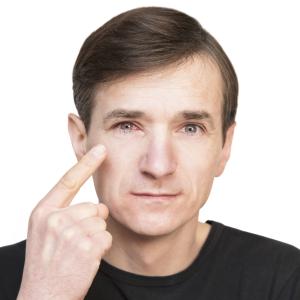 Eye Redness / Pain Treatment Near Me in Houston, TX and Livingston, TX