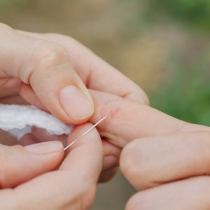 Fish Hook & Splinter Removal Specialist Near Me in Houston, TX and Livingston, TX