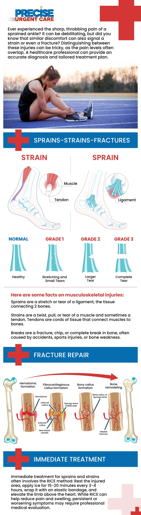 Common questions asked by patients: What is a bone fracture? What causes a bone fracture? What are the common symptoms of a bone fracture? What are the different types of bone fractures? How does urgent care treat bone fractures? How long does it take for a bone fracture to heal? At Precise Urgent Care in Livingston, TX, Board-Certified Dr. Rajan Popat, MD, and our team provide evaluation and stabilization for minor to moderate bone fractures. We utilize on-site digital X-rays to quickly identify the break and provide professional splinting or casting to ensure proper alignment. Visit our urgent care for immediate care that manages your pain and sets the foundation for a safe, effective recovery. For more information, contact us or online check-in. We are conveniently located at 1501 W Church St, #800 Livingston, TX 77351. We serve patients from Livingston TX, West Livingston TX, West Tempe TX, Leggett TX, Onalaska TX and surrounding areas. Common questions asked by patients: What is a bone fracture? What causes a bone fracture? What are the common symptoms of a bone fracture? What are the different types of bone fractures? How does urgent care treat bone fractures? How long does it take for a bone fracture to heal?
At Precise Urgent Care in Livingston, TX, Board-Certified Dr. Rajan Popat, MD, and our team provide evaluation and stabilization for minor to moderate bone fractures. We utilize on-site digital X-rays to quickly identify the break and provide professional splinting or casting to ensure proper alignment. Visit our urgent care for immediate care that manages your pain and sets the foundation for a safe, effective recovery. For more information, contact us or online check-in. We are conveniently located at 1501 W Church St, #800 Livingston, TX 77351. We serve patients from Livingston TX, West Livingston TX, West Tempe TX, Leggett TX, Onalaska TX and surrounding areas.