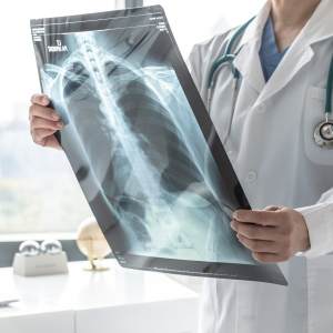 X-Ray Near Me in Houston, TX and Livingston, TX